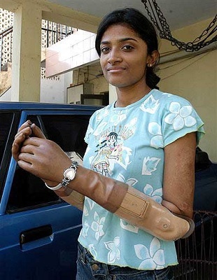 Malvika After Accident