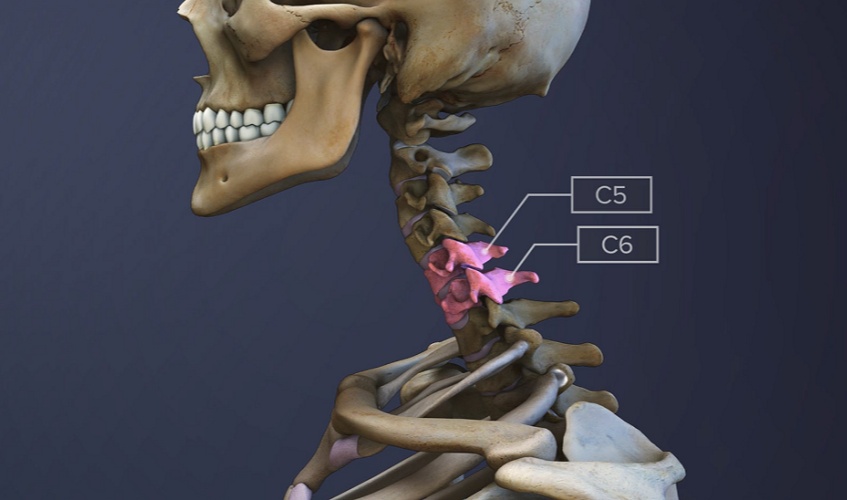 C5-C6-spinal-motion-segment