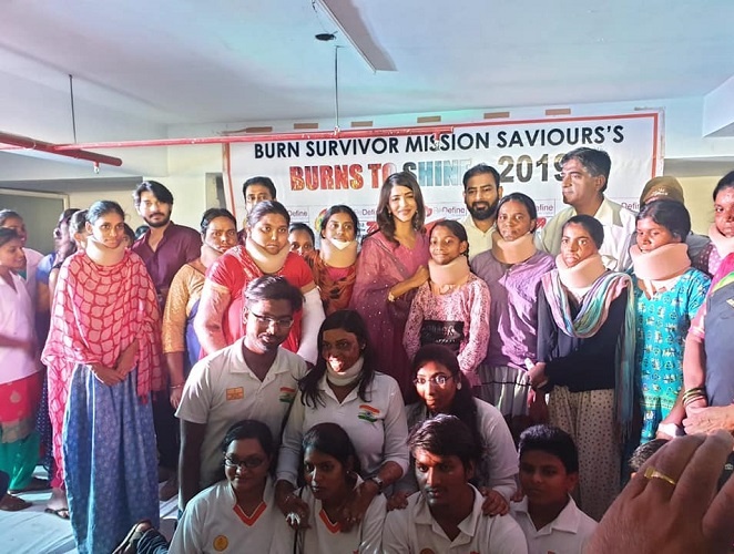 Burn Survivor Mission Saviour Trust